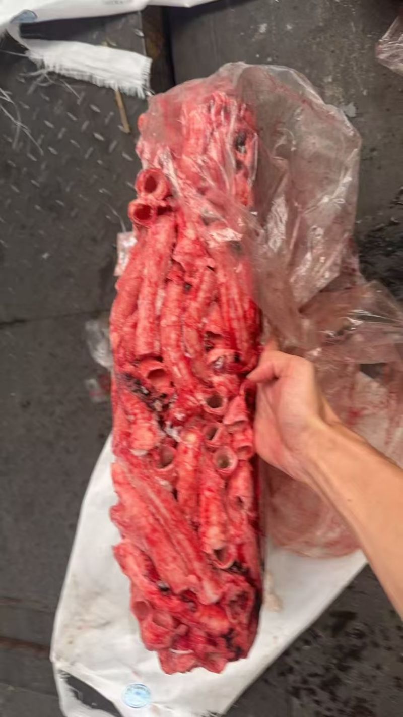 气管