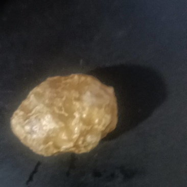 羊黄，羊结石