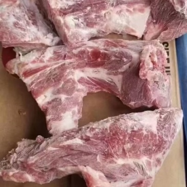 颈骨
