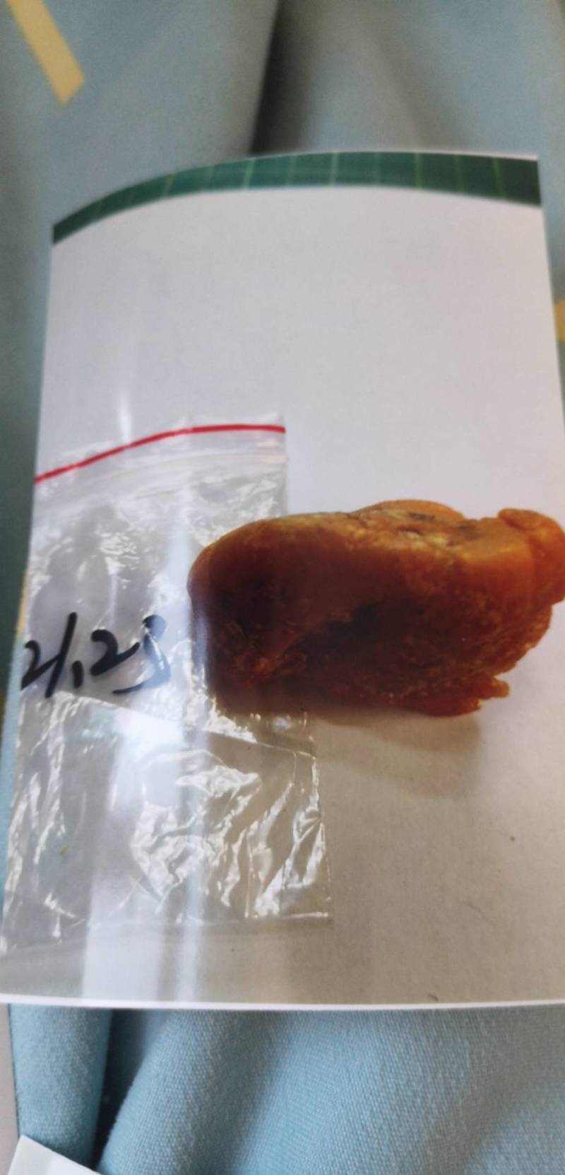 鸡宝，