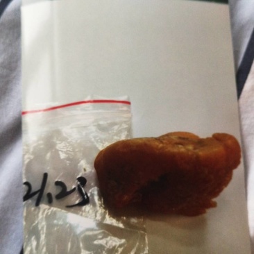 鸡宝，