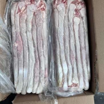 食管