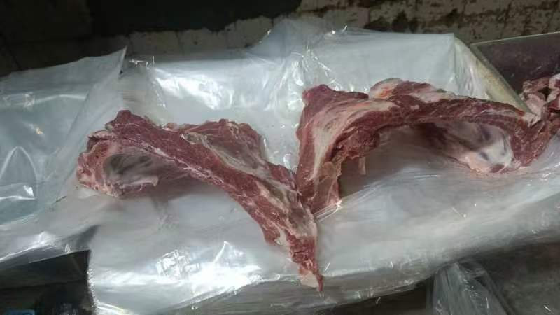 去颈前排