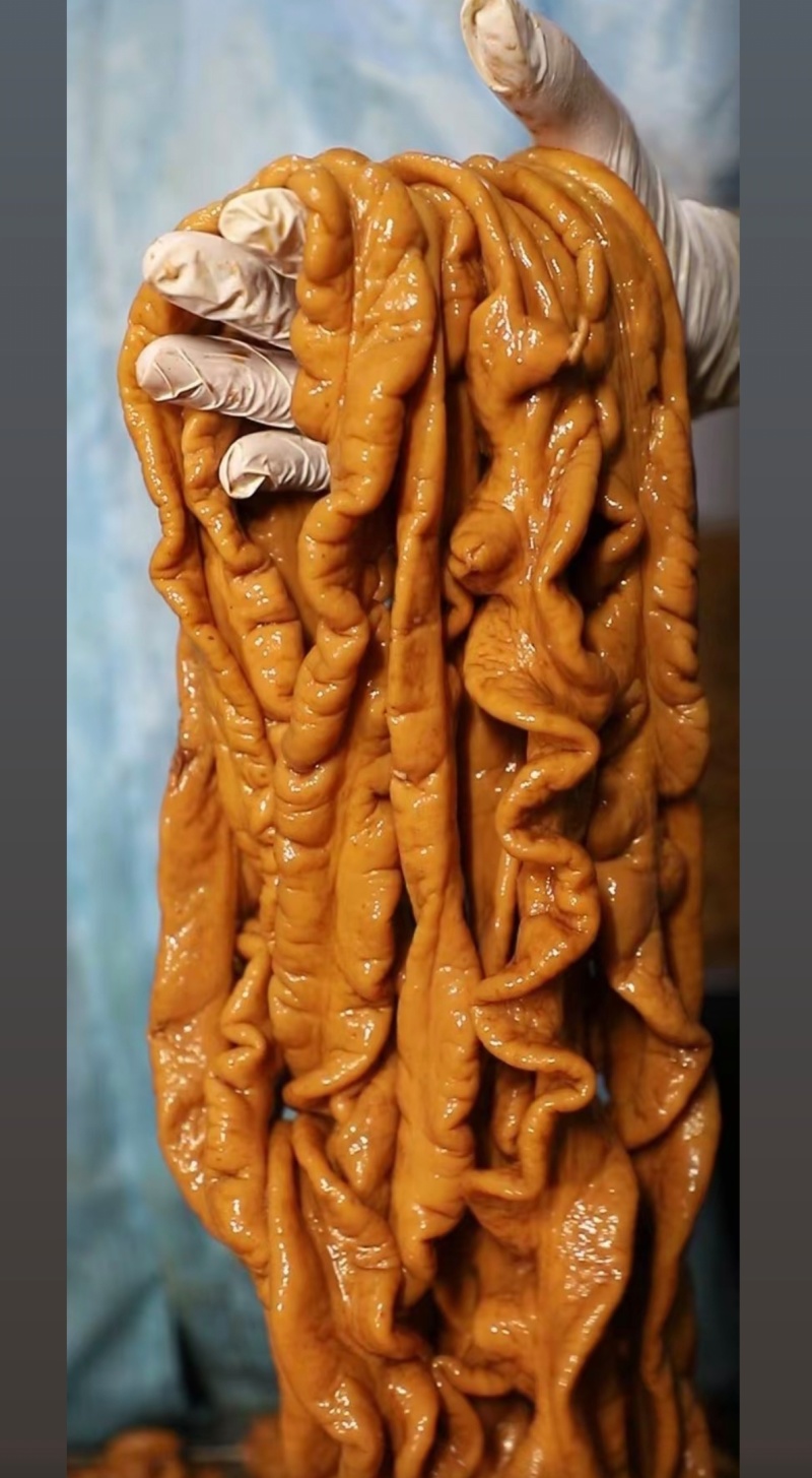 鑫业大肠，开箱实拍性价比非常高，饭店食堂都适合。
