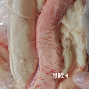 骨髓油