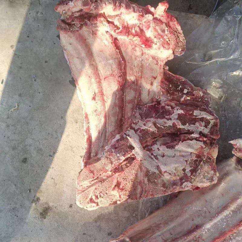 去颈前排