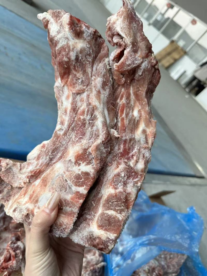 胫骨