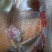 鸡宝