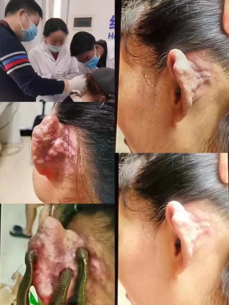 海南省**：医用水蛭，提供技术指导。