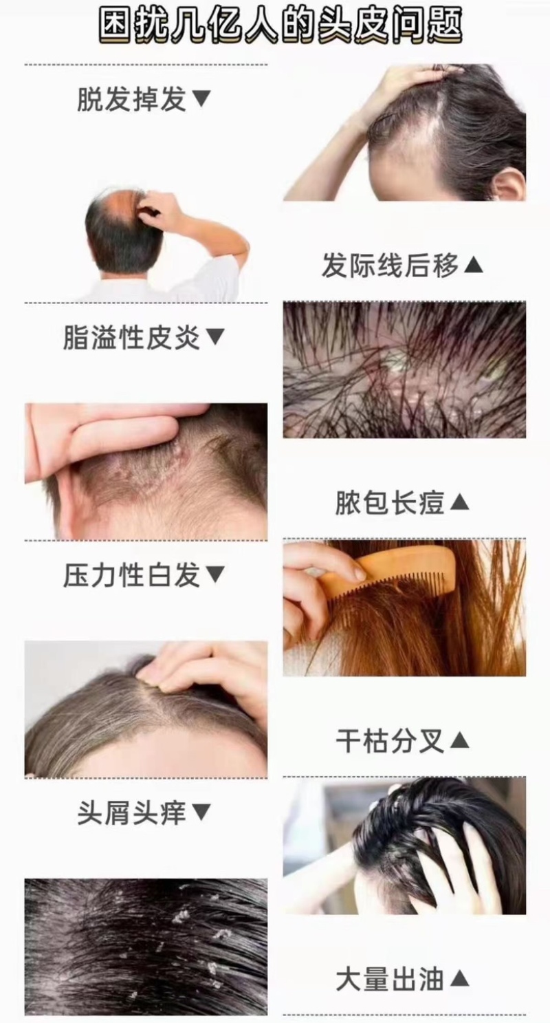 恩施中药洗发露