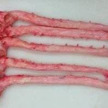 猪心管