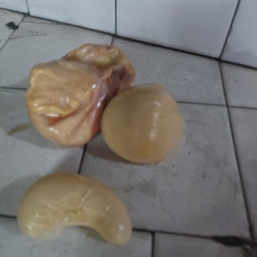 鸡宝