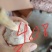 大蒜