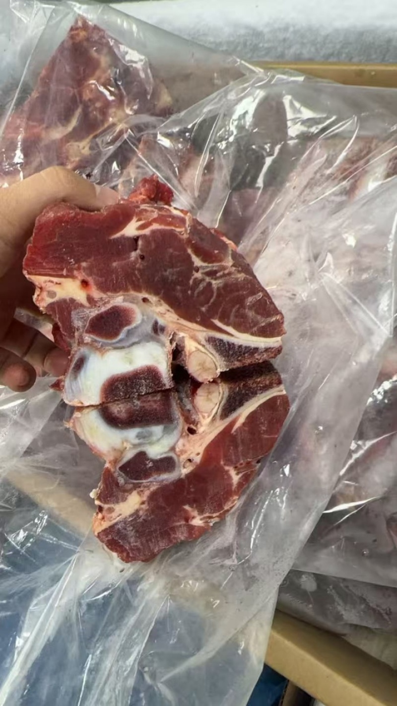 肩胛骨