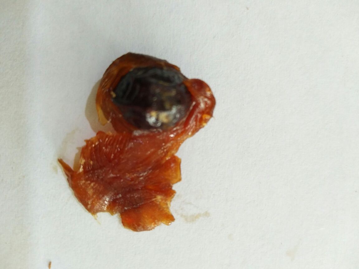 展示桂圆果肉与果核分离后的效果对比图,果肉完整,果核清晰可见 桂圆果肉与果核分离对比图