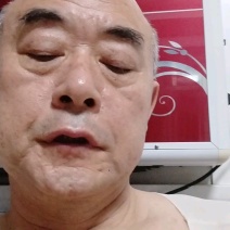 无花果干