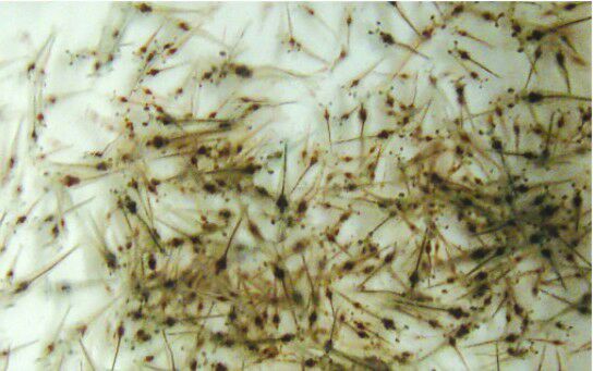 南美白对虾幼苗在显微镜下的形态特征