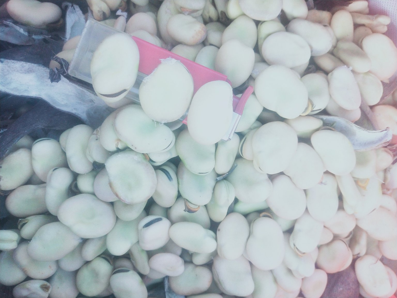 一名医生正在为儿童进行血液检测,背景有‘G6PD缺乏症’字样提示牌,桌上摆放着蚕豆样本和禁止食用标识 图片描述