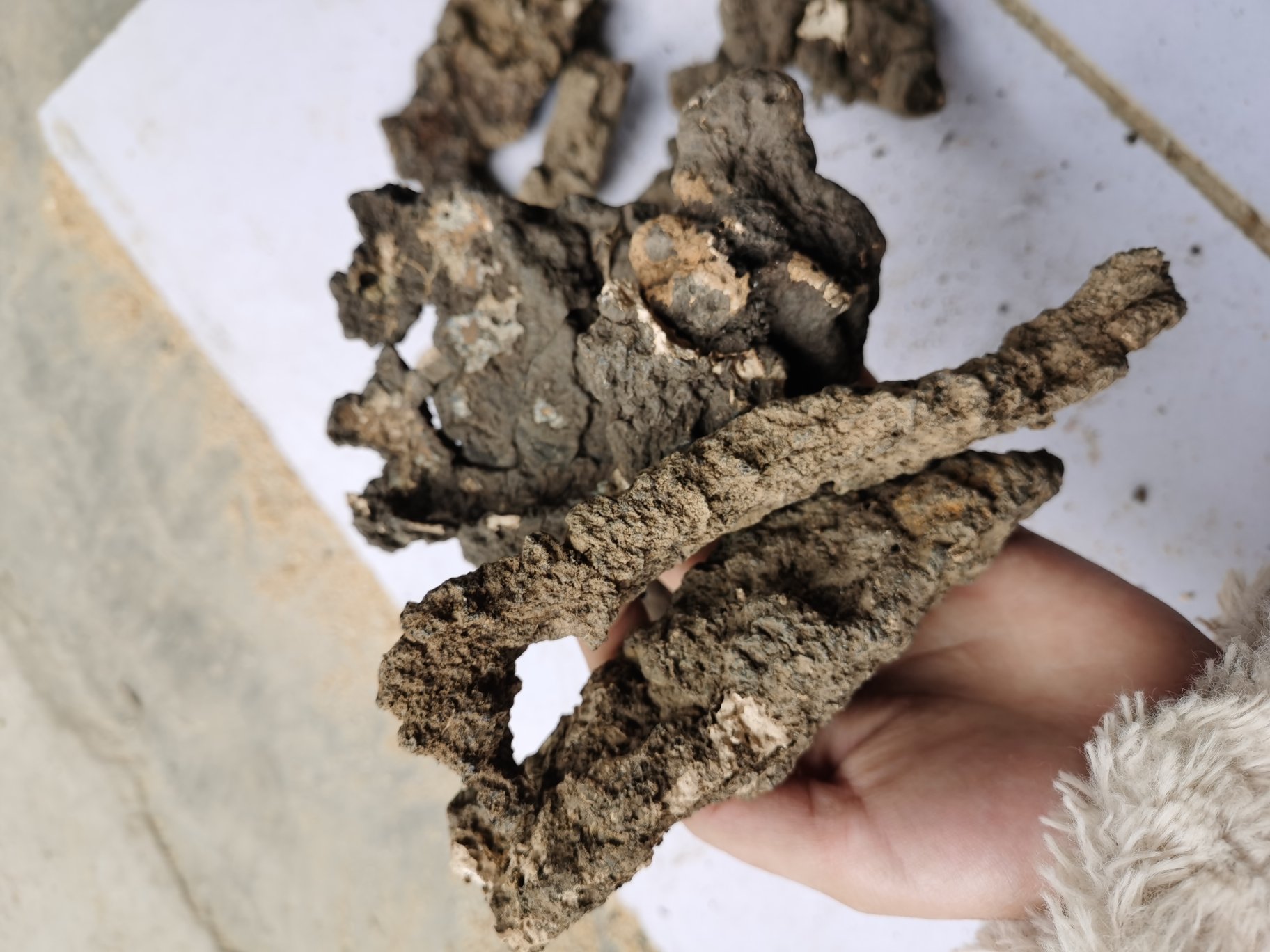 一位成年人坐在诊室中,医生正在讲解参苓白术丸的应用场景,背景展示脾虚湿盛型皮肤病的典型症状:面部油腻、眼睑浮肿、舌体胖大有齿痕、皮肤出现红斑脱屑等,配以参苓白术丸药盒与中药材组合图 参苓白术丸典型应用场景示意图